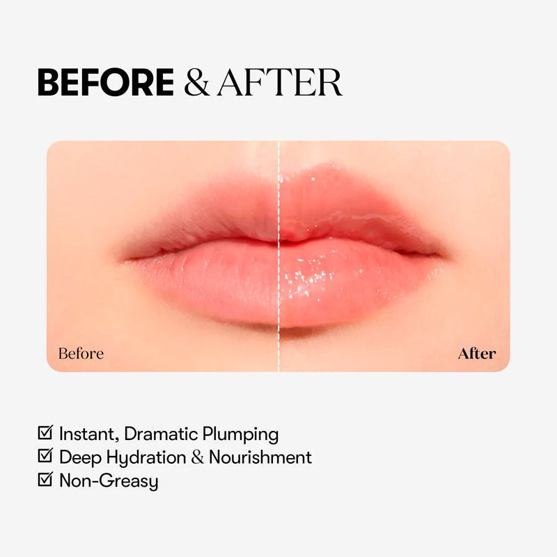 VT Reedle Shot Lip Plumper Expert (4 ml)
